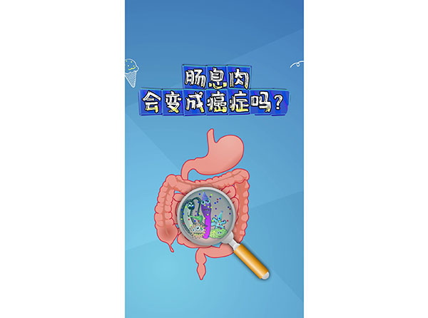 肠息肉会变成癌症吗？